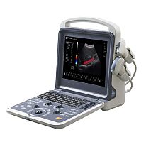 Portable ultrasound system K2for multipurpose ultrasound imagingB/Wcolor doppler