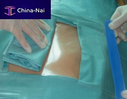 General surgery drape Incifilm®orthopedic surgerycardiac surgeryophthalmic surgery