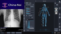 X-ray imaging software for controlacquisitionautomated