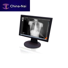 Radiology software Xview4visualizationfor tablet PC