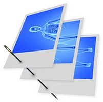 Orthopedic imaging software Stitching for veterinary imagingdata managementacquisition