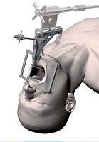 Right-angle pharyngoscope Satou
