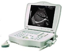 Portable ultrasound system LEO-3000E1 for multipurpose ultrasound imagingB/Wbuilt-in console